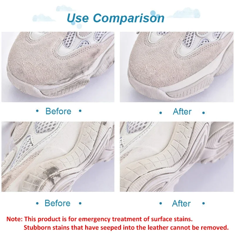 ممحاة تنظيف أحذية الجلد المدبو - مراجعة Sneaker Care Whitener وسعره