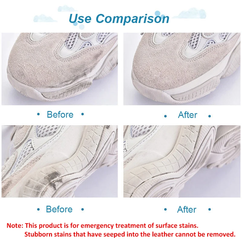 ممحاة تنظيف أحذية الجلد المدبو - مراجعة Sneaker Care Whitener وسعره