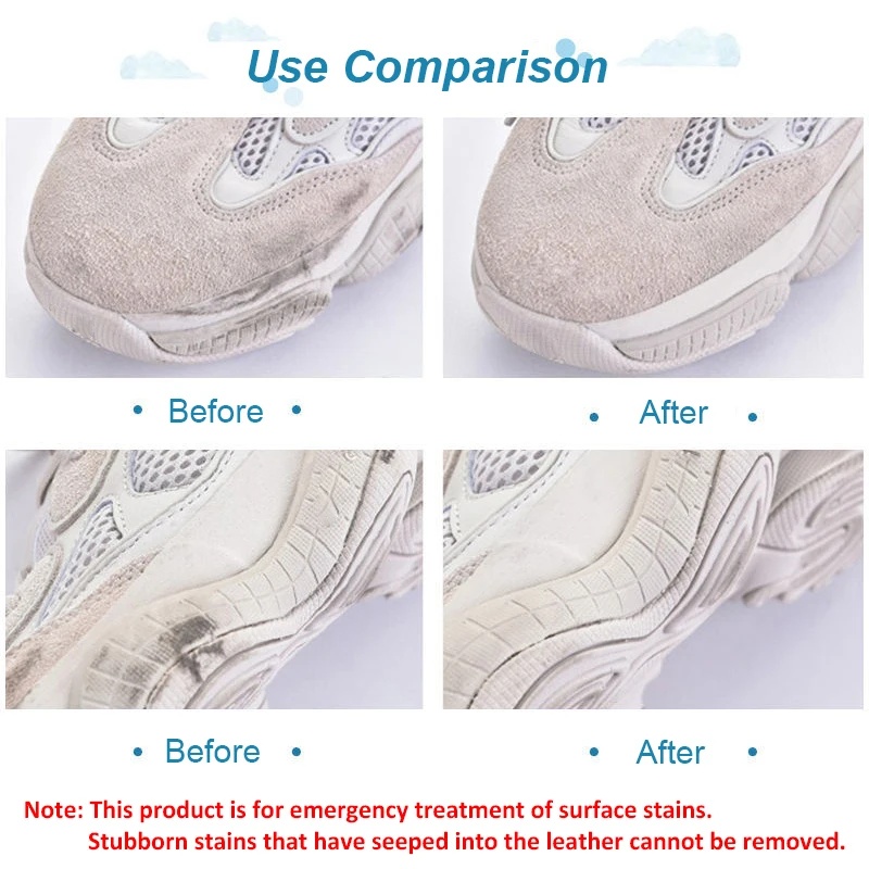 ممحاة تنظيف الأحذية الجلدية ال - مراجعة Sneaker Care Whitener وسعره