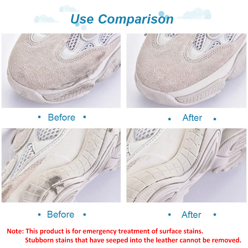 ممحاة تنظيف الأحذية مناسبة للج - مراجعة Sneaker Care Whitener وسعره
